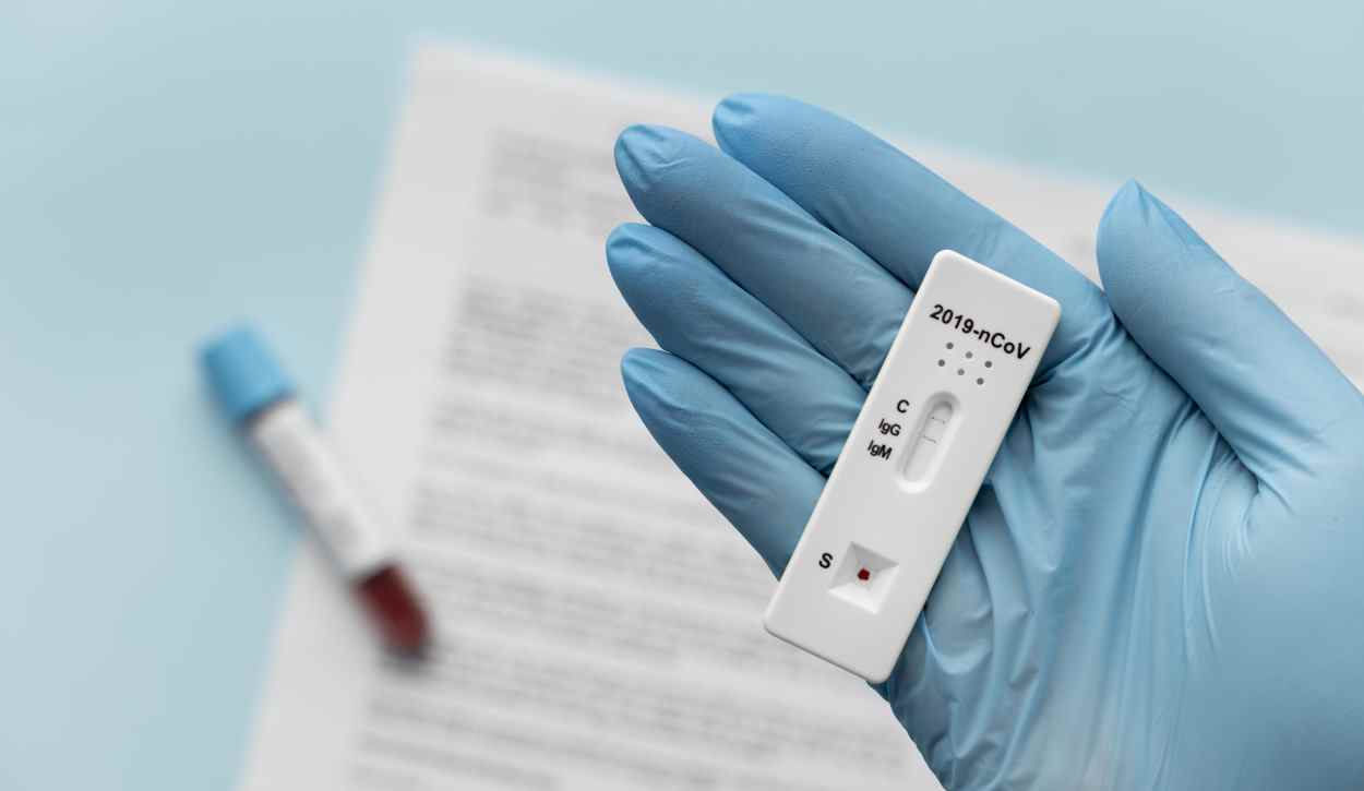 Saúde em Foz do Iguaçu está sem testes para covid-19